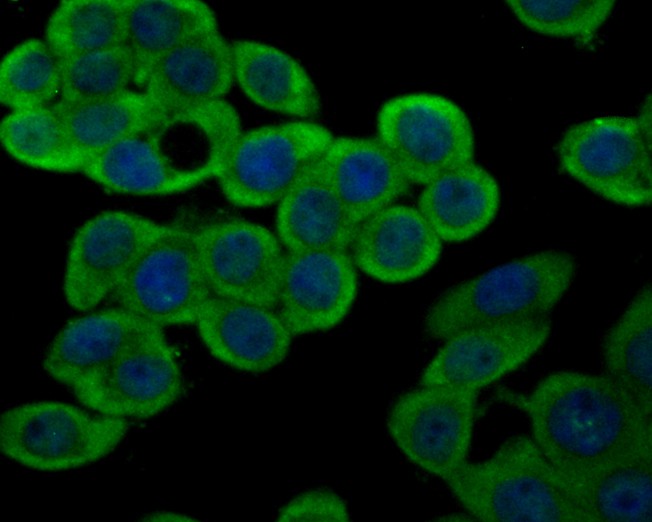 ICC staining of Connexin-37 in LOVO cells (green). Formalin fixed cells were permeabilized with 0.1% Triton X-100 in TBS for 10 minutes at room temperature and blocked with 1% Blocker BSA for 15 minutes at room temperature. Cells were probed with the primary antibody (ER1901-85, 1/100) for 1 hour at room temperature, washed with PBS. Alexa Fluor®488 Goat anti-Rabbit IgG was used as the secondary antibody at 1/100 dilution. The nuclear counter stain is DAPI (blue).