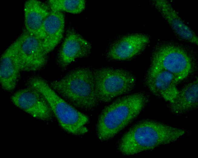 ICC staining of Connexin-37 in SKOV-3 cells (green). Formalin fixed cells were permeabilized with 0.1% Triton X-100 in TBS for 10 minutes at room temperature and blocked with 1% Blocker BSA for 15 minutes at room temperature. Cells were probed with the primary antibody (ER1901-85, 1/100) for 1 hour at room temperature, washed with PBS. Alexa Fluor®488 Goat anti-Rabbit IgG was used as the secondary antibody at 1/100 dilution. The nuclear counter stain is DAPI (blue).
