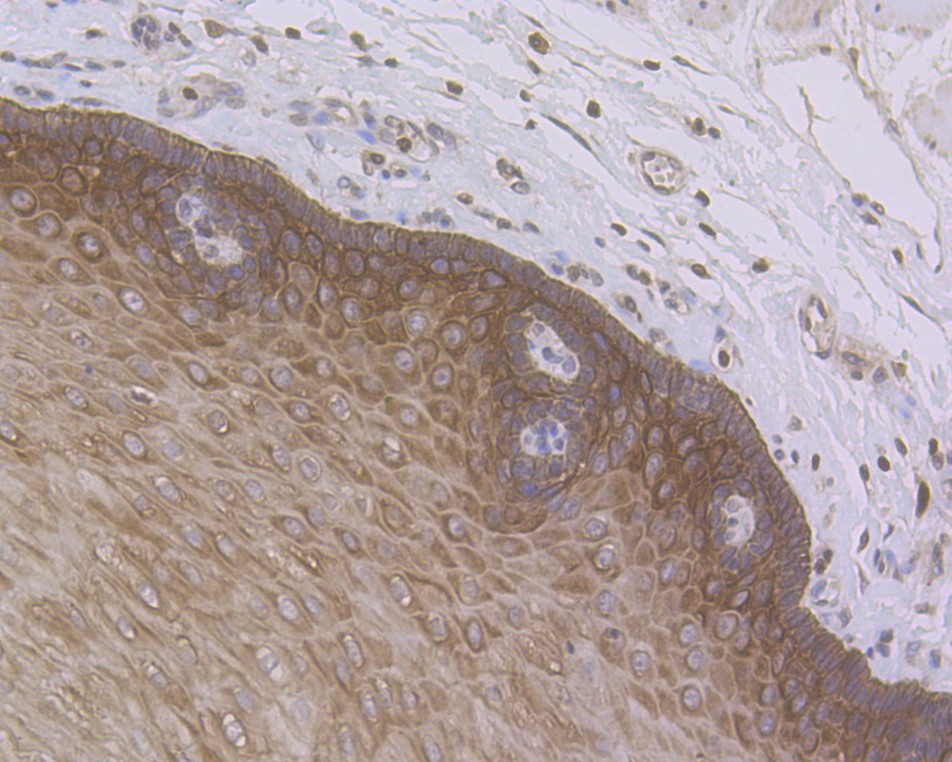 Immunohistochemical analysis of paraffin-embedded human esophagus tissue using anti-Cytokeratin 5+6 antibody. The section was pre-treated using heat mediated antigen retrieval with sodium citrate buffer (pH 6.0) for 20 minutes. The tissues were blocked in 5% BSA for 30 minutes at room temperature, washed with ddH2O and PBS, and then probed with the antibody (ER1901-86) at 1/50 dilution, for 30 minutes at room temperature and detected using an HRP conjugated compact polymer system. DAB was used as the chromogen. Counter stained with hematoxylin and mounted with DPX.