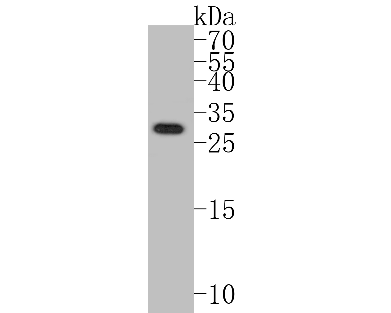 Western blot analysis of TMEM163 on human small intestine tissue lysates. Proteins were transferred to a PVDF membrane and blocked with 5% BSA in PBS for 1 hour at room temperature. The primary antibody (ER1901-87, 1/500) was used in 5% BSA at room temperature for 2 hours. Goat Anti-Rabbit IgG - HRP Secondary Antibody (HA1001) at 1:5,000 dilution was used for 1 hour at room temperature.