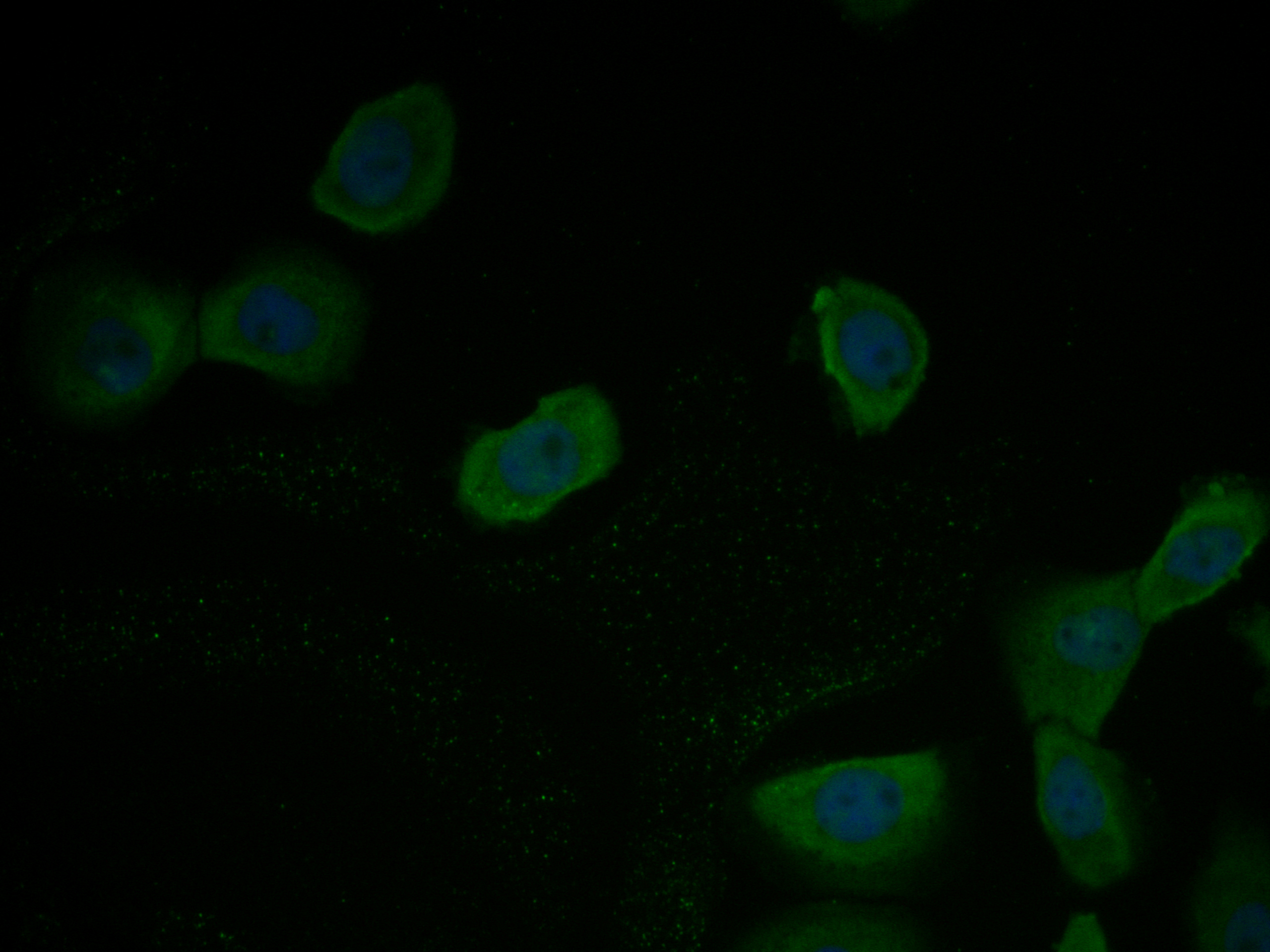 ICC staining of TMEM163 in A431 cells (green). Formalin fixed cells were permeabilized with 0.1% Triton X-100 in TBS for 10 minutes at room temperature and blocked with 1% Blocker BSA for 15 minutes at room temperature. Cells were probed with the primary antibody (ER1901-87, 1/200) for 1 hour at room temperature, washed with PBS. Alexa Fluor®488 Goat anti-Rabbit IgG was used as the secondary antibody at 1/1,000 dilution. The nuclear counter stain is DAPI (blue).