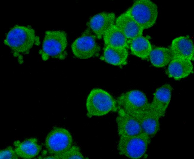 ICC staining of CNGA4 in N2A cells (green). Formalin fixed cells were permeabilized with 0.1% Triton X-100 in TBS for 10 minutes at room temperature and blocked with 1% Blocker BSA for 15 minutes at room temperature. Cells were probed with the primary antibody (ER1901-88, 1/100) for 1 hour at room temperature, washed with PBS. Alexa Fluor®488 Goat anti-Rabbit IgG was used as the secondary antibody at 1/100 dilution. The nuclear counter stain is DAPI (blue).