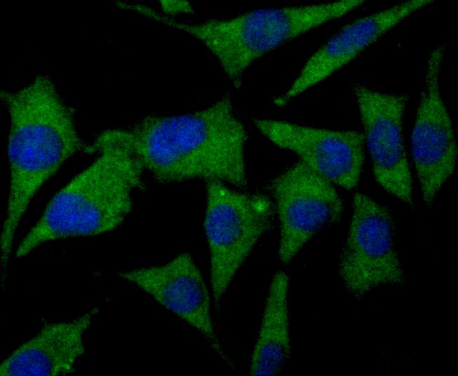 ICC staining of CNGA4 in SHSY5Y cells (green). Formalin fixed cells were permeabilized with 0.1% Triton X-100 in TBS for 10 minutes at room temperature and blocked with 1% Blocker BSA for 15 minutes at room temperature. Cells were probed with the primary antibody (ER1901-88, 1/100) for 1 hour at room temperature, washed with PBS. Alexa Fluor®488 Goat anti-Rabbit IgG was used as the secondary antibody at 1/100 dilution. The nuclear counter stain is DAPI (blue).