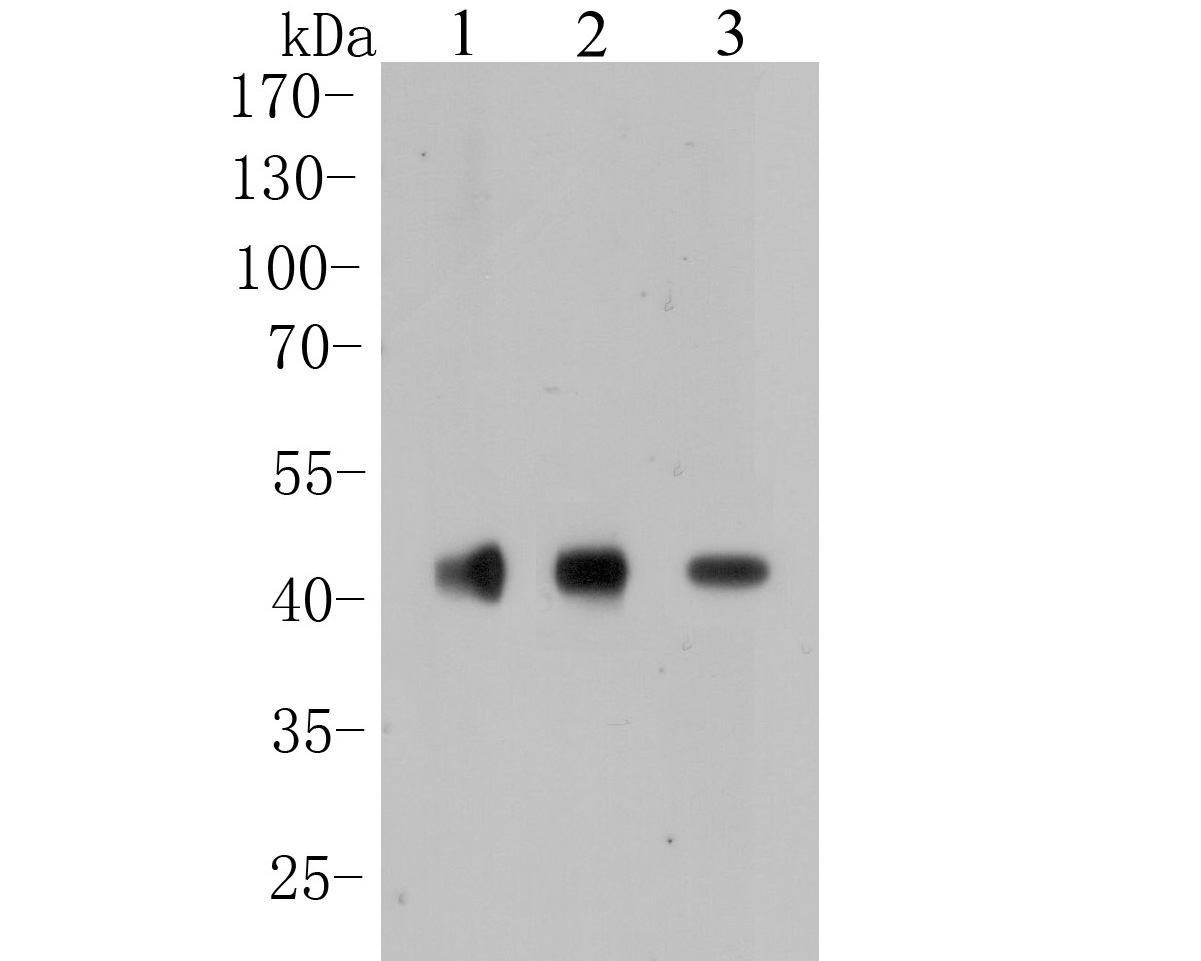 Western blot analysis of CACNG2 on different lysates. Proteins were transferred to a PVDF membrane and blocked with 5% BSA in PBS for 1 hour at room temperature. The primary antibody (ER1901-89, 1/500) was used in 5% BSA at room temperature for 2 hours. Goat Anti-Rabbit IgG - HRP Secondary Antibody (HA1001) at 1:5,000 dilution was used for 1 hour at room temperature.<br />
Positive control: <br />
Lane 1: Mouse cerebellum tissue lysate<br />
Lane 2: Mouse brain tissue lysate<br />
Lane 3: Rat brain tissue lysate<br />
Predicted band size: 36 kDa<br />
Observed band size: 41 kDa