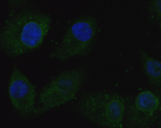 ICC staining of CACNG2 in A549 cells (green). Formalin fixed cells were permeabilized with 0.1% Triton X-100 in TBS for 10 minutes at room temperature and blocked with 1% Blocker BSA for 15 minutes at room temperature. Cells were probed with the primary antibody (ER1901-89, 1/200) for 1 hour at room temperature, washed with PBS. Alexa Fluor®488 Goat anti-Rabbit IgG was used as the secondary antibody at 1/100 dilution. The nuclear counter stain is DAPI (blue).