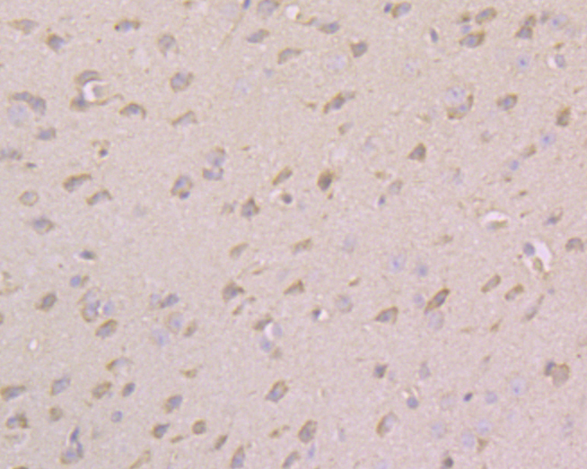 Immunohistochemical analysis of paraffin-embedded mouse brain tissue using anti-CACNG2 antibody. The section was pre-treated using heat mediated antigen retrieval with Tris-EDTA buffer (pH 8.0-8.4) for 20 minutes.The tissues were blocked in 5% BSA for 30 minutes at room temperature, washed with ddH2O and PBS, and then probed with the primary antibody (ER1901-89, 1/100) for 30 minutes at room temperature. The detection was performed using an HRP conjugated compact polymer system. DAB was used as the chromogen. Tissues were counterstained with hematoxylin and mounted with DPX.
