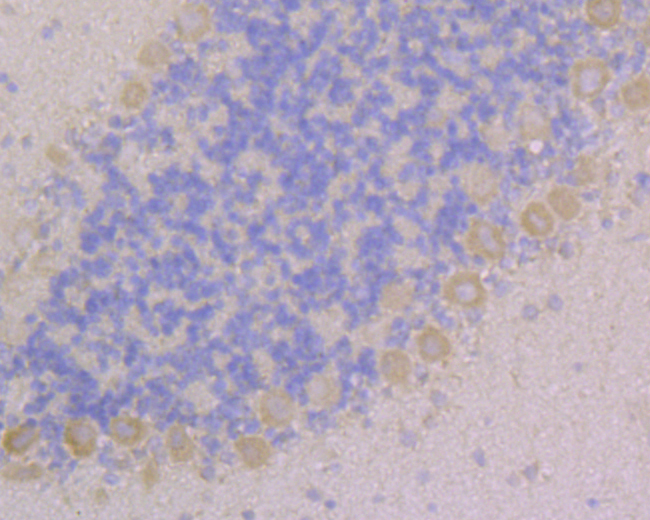 Immunohistochemical analysis of paraffin-embedded rat Cerebellum tissue using anti-CACNG2 antibody. The section was pre-treated using heat mediated antigen retrieval with Tris-EDTA buffer (pH 8.0-8.4) for 20 minutes.The tissues were blocked in 5% BSA for 30 minutes at room temperature, washed with ddH2O and PBS, and then probed with the primary antibody (ER1901-89, 1/100) for 30 minutes at room temperature. The detection was performed using an HRP conjugated compact polymer system. DAB was used as the chromogen. Tissues were counterstained with hematoxylin and mounted with DPX.