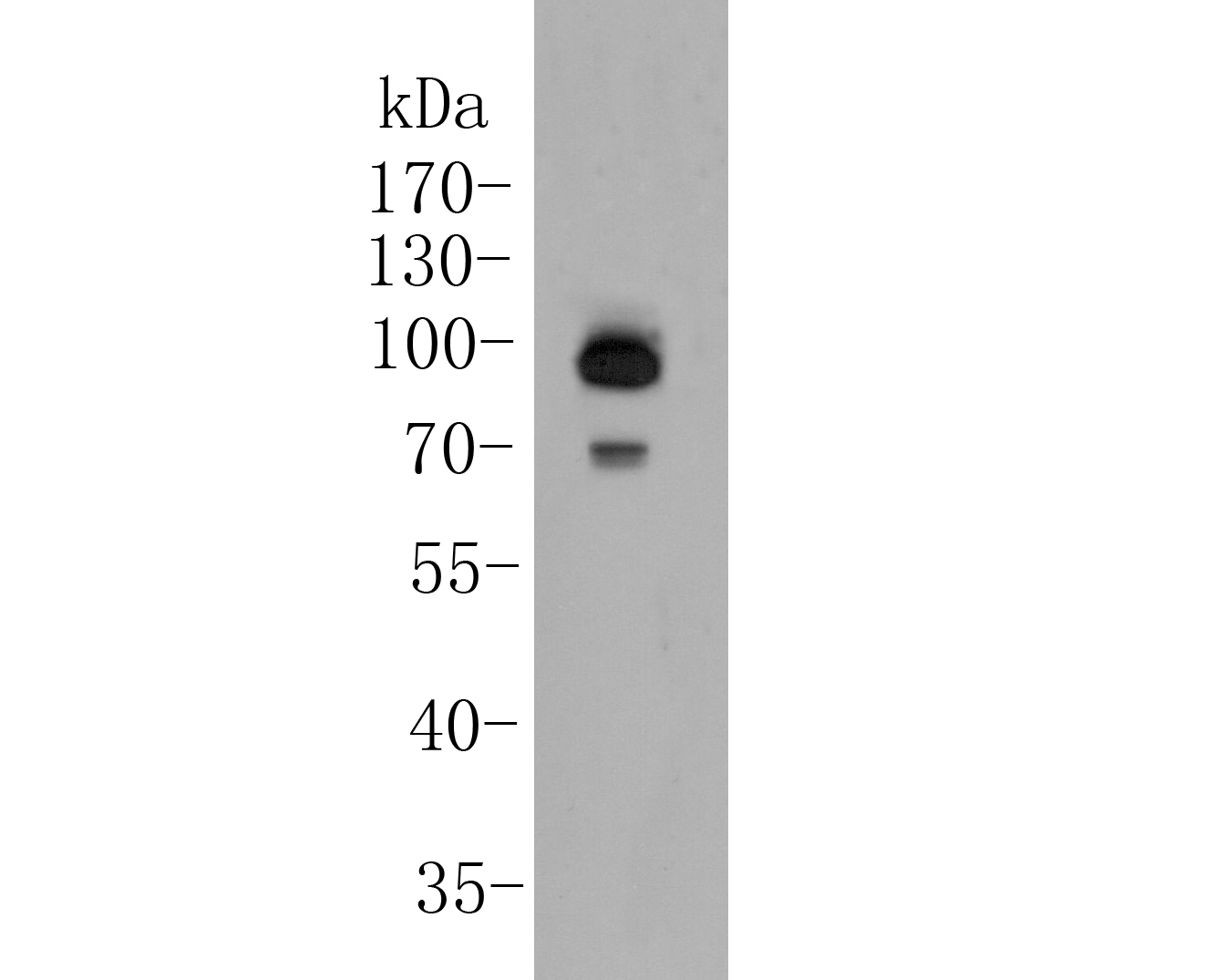 Western blot analysis of delta 1 Catenin/CAS on HUVEC cell lysate. Proteins were transferred to a PVDF membrane and blocked with 5% BSA in PBS for 1 hour at room temperature. The primary antibody (ER1901-92, 1/1000) was used in 5% BSA at room temperature for 2 hours. Goat Anti-Rabbit IgG - HRP Secondary Antibody (HA1001) at 1:5,000 dilution was used for 1 hour at room temperature.
