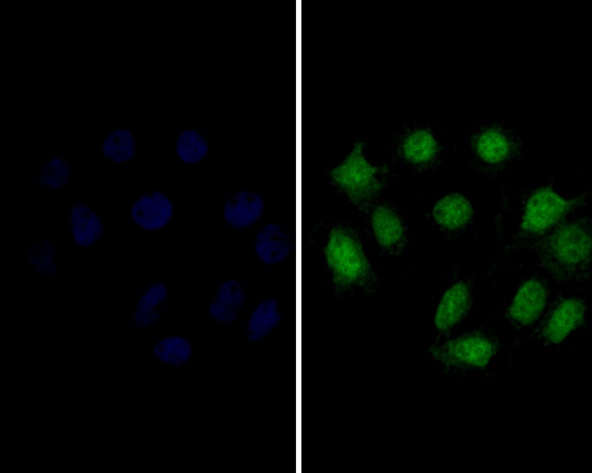 ICC staining of delta 1 Catenin/CAS in A431 cells (green). Formalin fixed cells were permeabilized with 0.1% Triton X-100 in TBS for 10 minutes at room temperature and blocked with 1% Blocker BSA for 15 minutes at room temperature. Cells were probed with the primary antibody (ER1901-92, 1/100) for 1 hour at room temperature, washed with PBS. Alexa Fluor®488 Goat anti-Rabbit IgG was used as the secondary antibody at 1/100 dilution. The nuclear counter stain is DAPI (blue).
