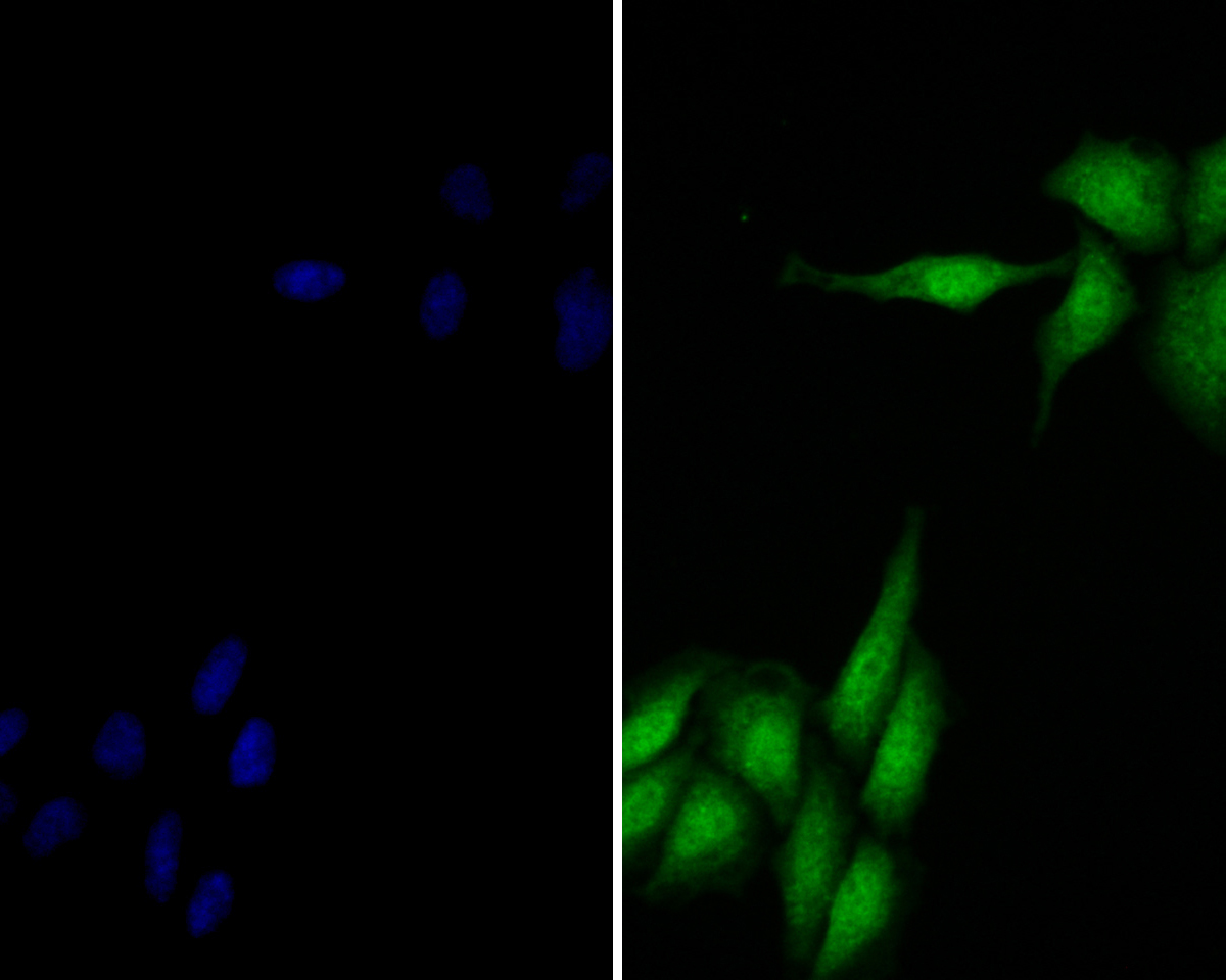 ICC staining of delta 1 Catenin/CAS in Siha cells (green). Formalin fixed cells were permeabilized with 0.1% Triton X-100 in TBS for 10 minutes at room temperature and blocked with 1% Blocker BSA for 15 minutes at room temperature. Cells were probed with the primary antibody (ER1901-92, 1/100) for 1 hour at room temperature, washed with PBS. Alexa Fluor®488 Goat anti-Rabbit IgG was used as the secondary antibody at 1/100 dilution. The nuclear counter stain is DAPI (blue).
