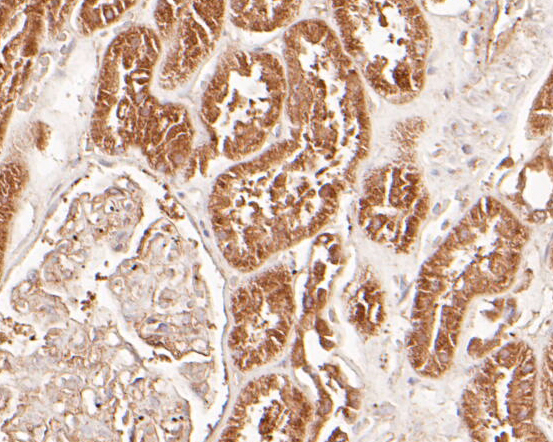 Immunohistochemical analysis of paraffin-embedded human kidney tissue using anti-delta 1 Catenin/CAS antibody. The section was pre-treated using heat mediated antigen retrieval with Tris-EDTA buffer (pH 8.0-8.4) for 20 minutes.The tissues were blocked in 5% BSA for 30 minutes at room temperature, washed with ddH2O and PBS, and then probed with the primary antibody (ER1901-92, 1/100) for 30 minutes at room temperature. The detection was performed using an HRP conjugated compact polymer system. DAB was used as the chromogen. Tissues were counterstained with hematoxylin and mounted with DPX.