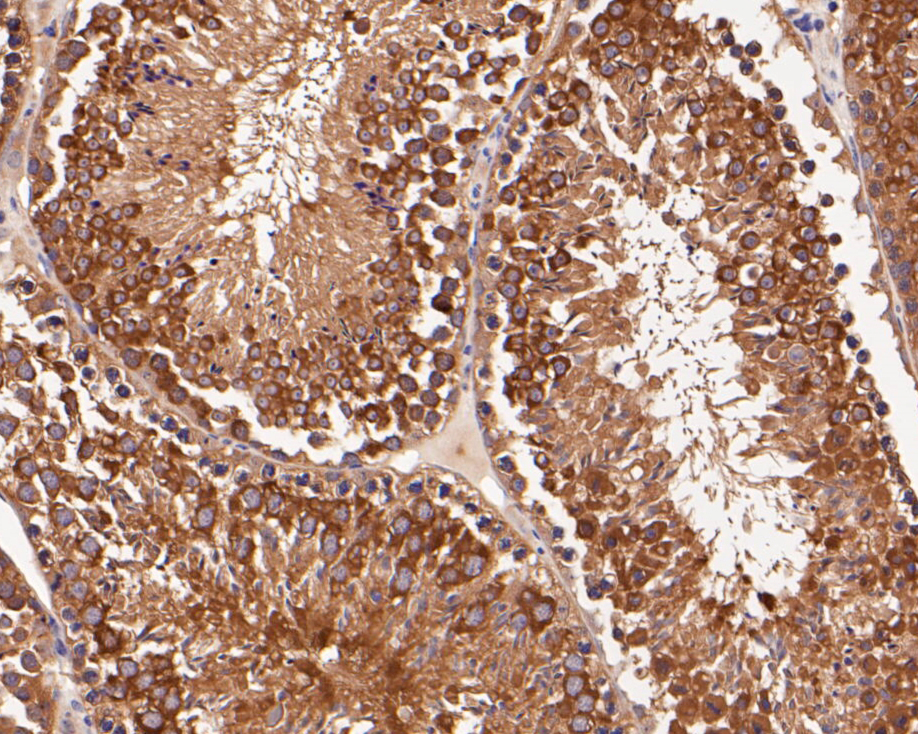 Immunohistochemical analysis of paraffin-embedded mouse testis tissue using anti-delta 1 Catenin/CAS antibody. The section was pre-treated using heat mediated antigen retrieval with Tris-EDTA buffer (pH 8.0-8.4) for 20 minutes.The tissues were blocked in 5% BSA for 30 minutes at room temperature, washed with ddH2O and PBS, and then probed with the primary antibody (ER1901-92, 1/100) for 30 minutes at room temperature. The detection was performed using an HRP conjugated compact polymer system. DAB was used as the chromogen. Tissues were counterstained with hematoxylin and mounted with DPX.