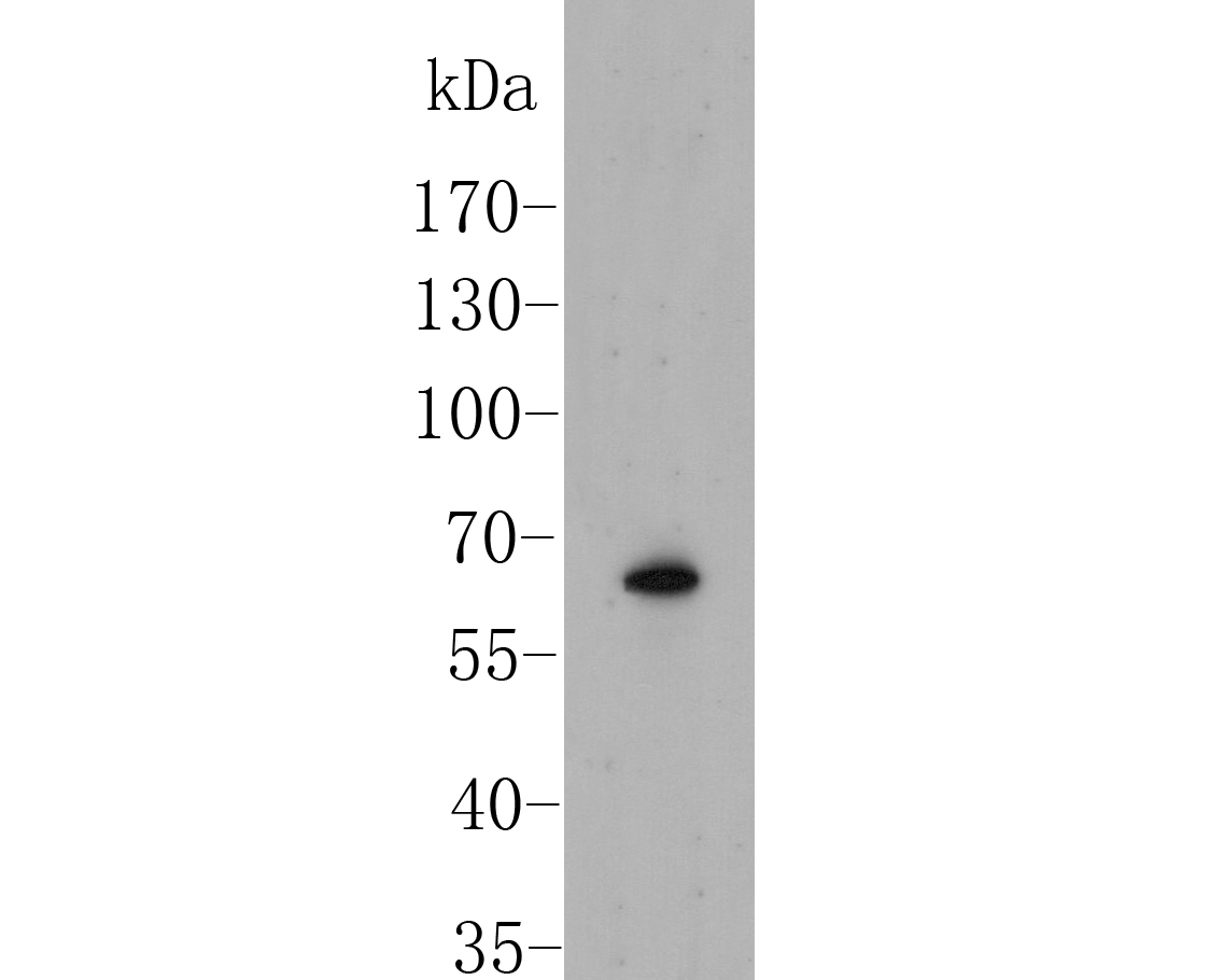 Western blot analysis of SLC8B1 on mouse tonsil tissue lysate. Proteins were transferred to a PVDF membrane and blocked with 5% BSA in PBS for 1 hour at room temperature. The primary antibody (ER1901-93, 1/500) was used in 5% BSA at room temperature for 2 hours. Goat Anti-Rabbit IgG - HRP Secondary Antibody (HA1001) at 1:5,000 dilution was used for 1 hour at room temperature.