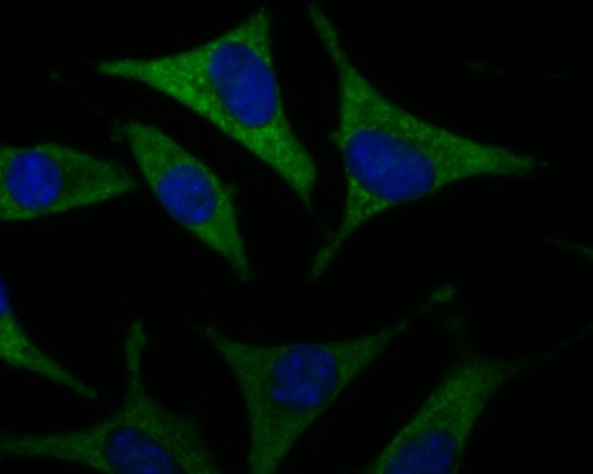 ICC staining of SLC8B1 in SHSY5Y cells (green). Formalin fixed cells were permeabilized with 0.1% Triton X-100 in TBS for 10 minutes at room temperature and blocked with 1% Blocker BSA for 15 minutes at room temperature. Cells were probed with the primary antibody (ER1901-93, 1/100) for 1 hour at room temperature, washed with PBS. Alexa Fluor®488 Goat anti-Rabbit IgG was used as the secondary antibody at 1/100 dilution. The nuclear counter stain is DAPI (blue).