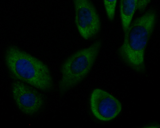 ICC staining of SLC8B1 in SKOV-3 cells (green). Formalin fixed cells were permeabilized with 0.1% Triton X-100 in TBS for 10 minutes at room temperature and blocked with 1% Blocker BSA for 15 minutes at room temperature. Cells were probed with the primary antibody (ER1901-93, 1/100) for 1 hour at room temperature, washed with PBS. Alexa Fluor®488 Goat anti-Rabbit IgG was used as the secondary antibody at 1/100 dilution. The nuclear counter stain is DAPI (blue).