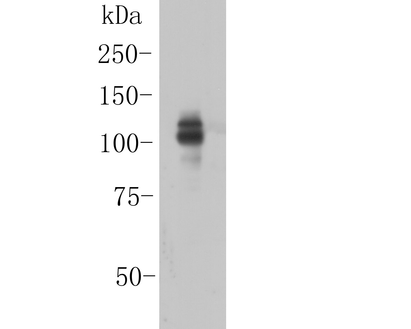 Western blot analysis of ITCH on Siha cell  lysate. Proteins were transferred to a PVDF membrane and blocked with 5% BSA in PBS for 1 hour at room temperature. The primary antibody (ER1901-94, 1/2000) was used in 5% BSA at room temperature for 2 hours. Goat Anti-Rabbit IgG - HRP Secondary Antibody (HA1001) at 1:5,000 dilution was used for 1 hour at room temperature.