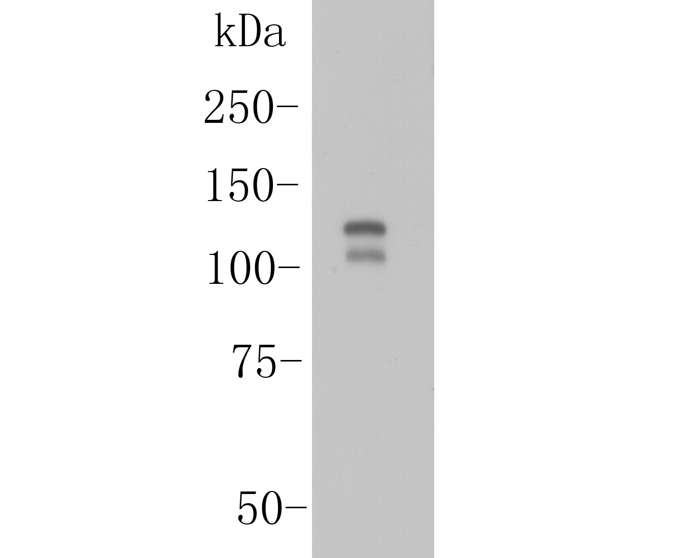 Western blot analysis of ITCH on Mouse pancreatic tissue lysate. Proteins were transferred to a PVDF membrane and blocked with 5% BSA in PBS for 1 hour at room temperature. The primary antibody (ER1901-94, 1/1000) was used in 5% BSA at room temperature for 2 hours. Goat Anti-Rabbit IgG - HRP Secondary Antibody (HA1001) at 1:5,000 dilution was used for 1 hour at room temperature.