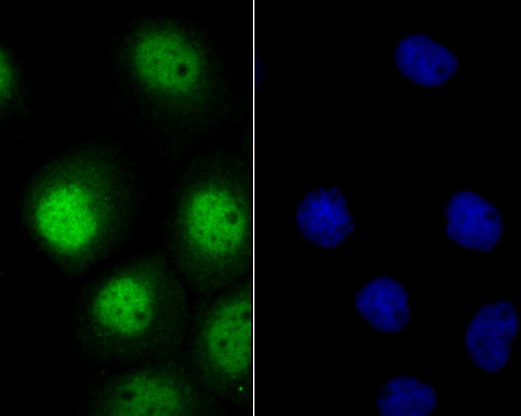 ICC staining of A431 in Hela cells (green). Formalin fixed cells were permeabilized with 0.1% Triton X-100 in TBS for 10 minutes at room temperature and blocked with 1% Blocker BSA for 15 minutes at room temperature. Cells were probed with the primary antibody (ER1901-94, 1/200) for 1 hour at room temperature, washed with PBS. Alexa Fluor®488 Goat anti-Rabbit IgG was used as the secondary antibody at 1/100 dilution. The nuclear counter stain is DAPI (blue).