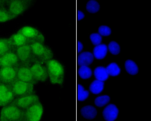 ICC staining of ITCH in Siha cells (green). Formalin fixed cells were permeabilized with 0.1% Triton X-100 in TBS for 10 minutes at room temperature and blocked with 1% Blocker BSA for 15 minutes at room temperature. Cells were probed with the primary antibody (ER1901-94, 1/200) for 1 hour at room temperature, washed with PBS. Alexa Fluor®488 Goat anti-Rabbit IgG was used as the secondary antibody at 1/100 dilution. The nuclear counter stain is DAPI (blue).