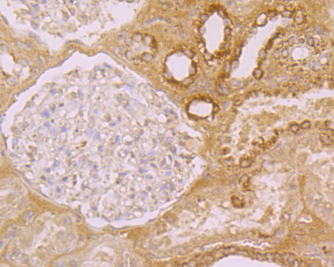 Immunohistochemical analysis of paraffin-embedded human kidney tissue using anti-FOLR1 antibody. The section was pre-treated using heat mediated antigen retrieval with Tris-EDTA buffer (pH 8.0-8.4) for 20 minutes.The tissues were blocked in 5% BSA for 30 minutes at room temperature, washed with ddH2O and PBS, and then probed with the primary antibody (ER1901-95, 1/100) for 30 minutes at room temperature. The detection was performed using an HRP conjugated compact polymer system. DAB was used as the chromogen. Tissues were counterstained with hematoxylin and mounted with DPX.