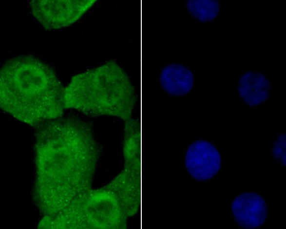 ICC staining of Progesterone receptor in A549 cells (green). Formalin fixed cells were permeabilized with 0.1% Triton X-100 in TBS for 10 minutes at room temperature and blocked with 1% Blocker BSA for 15 minutes at room temperature. Cells were probed with the primary antibody (ER1901-96, 1/100) for 1 hour at room temperature, washed with PBS. Alexa Fluor®488 Goat anti-Rabbit IgG was used as the secondary antibody at 1/100 dilution. The nuclear counter stain is DAPI (blue).