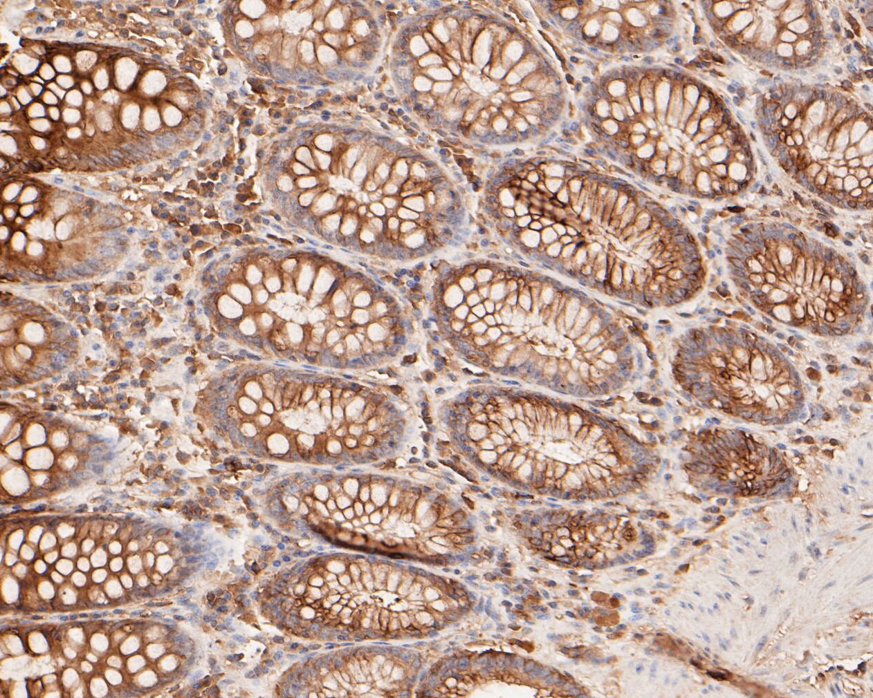 Immunohistochemical analysis of paraffin-embedded human colon tissue using anti-Cytokeratin 20 antibody. The section was pre-treated using heat mediated antigen retrieval with Tris-EDTA buffer (pH 8.0-8.4) for 20 minutes.The tissues were blocked in 5% BSA for 30 minutes at room temperature, washed with ddH2O and PBS, and then probed with the primary antibody (ER1901-97, 1/50) for 30 minutes at room temperature. The detection was performed using an HRP conjugated compact polymer system. DAB was used as the chromogen. Tissues were counterstained with hematoxylin and mounted with DPX.