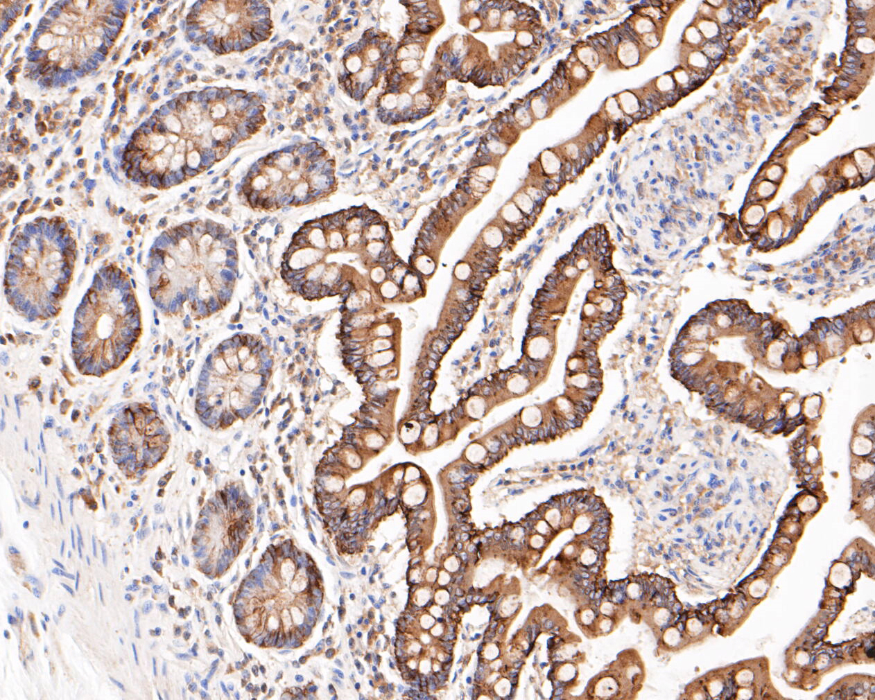 Immunohistochemical analysis of paraffin-embedded human small intestine tissue using anti-Cytokeratin 20 antibody. The section was pre-treated using heat mediated antigen retrieval with Tris-EDTA buffer (pH 8.0-8.4) for 20 minutes.The tissues were blocked in 5% BSA for 30 minutes at room temperature, washed with ddH2O and PBS, and then probed with the primary antibody (ER1901-97, 1/200) for 30 minutes at room temperature. The detection was performed using an HRP conjugated compact polymer system. DAB was used as the chromogen. Tissues were counterstained with hematoxylin and mounted with DPX.