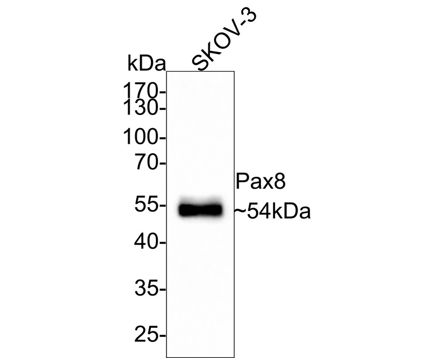 Western blot analysis of Pax8 on SKOV-3 cell lysate. Proteins were transferred to a PVDF membrane and blocked with 5% BSA in PBS for 1 hour at room temperature. The primary antibody (ER1901-98, 1/500) was used in 5% BSA at room temperature for 2 hours. Goat Anti-Rabbit IgG - HRP Secondary Antibody (HA1001) at 1:5,000 dilution was used for 1 hour at room temperature.