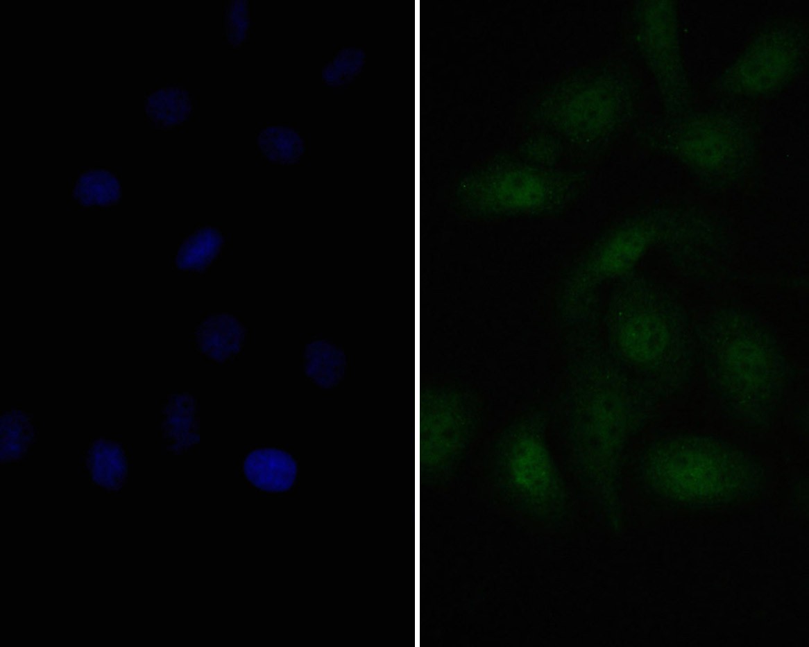ICC staining of Pax8 in SKOV-3 cells (green). Formalin fixed cells were permeabilized with 0.1% Triton X-100 in TBS for 10 minutes at room temperature and blocked with 1% Blocker BSA for 15 minutes at room temperature. Cells were probed with the primary antibody (ER1901-98, 1/100) for 1 hour at room temperature, washed with PBS. Alexa Fluor®488 Goat anti-Rabbit IgG was used as the secondary antibody at 1/100 dilution. The nuclear counter stain is DAPI (blue).