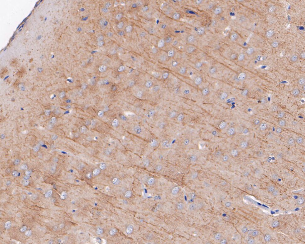 Immunohistochemical analysis of paraffin-embedded rat brain tissue using anti-P2X7 antibody. The section was pre-treated using heat mediated antigen retrieval with Tris-EDTA buffer (pH 8.0-8.4) for 20 minutes.The tissues were blocked in 5% BSA for 30 minutes at room temperature, washed with ddH2O and PBS, and then probed with the primary antibody (ER1901-99, 1/200) for 30 minutes at room temperature. The detection was performed using an HRP conjugated compact polymer system. DAB was used as the chromogen. Tissues were counterstained with hematoxylin and mounted with DPX.