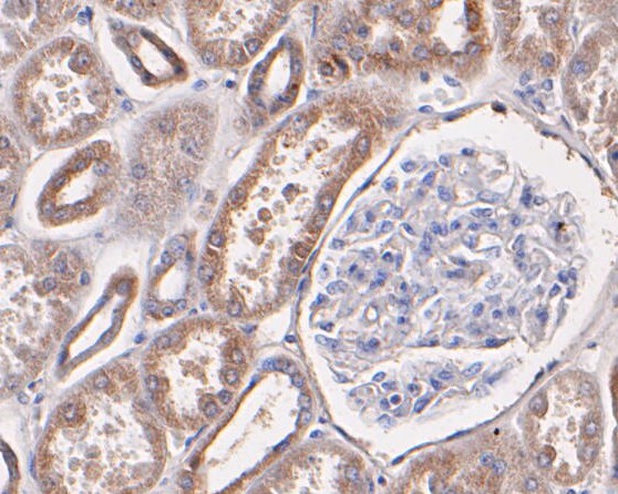Immunohistochemical analysis of paraffin-embedded human kidney tissue using anti-P2X7 antibody. The section was pre-treated using heat mediated antigen retrieval with Tris-EDTA buffer (pH 8.0-8.4) for 20 minutes.The tissues were blocked in 5% BSA for 30 minutes at room temperature, washed with ddH2O and PBS, and then probed with the primary antibody (ER1901-99, 1/50) for 30 minutes at room temperature. The detection was performed using an HRP conjugated compact polymer system. DAB was used as the chromogen. Tissues were counterstained with hematoxylin and mounted with DPX.