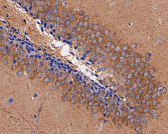 Immunohistochemical analysis of paraffin-embedded mouse brain tissue using anti-P2X7 antibody. The section was pre-treated using heat mediated antigen retrieval with Tris-EDTA buffer (pH 8.0-8.4) for 20 minutes.The tissues were blocked in 5% BSA for 30 minutes at room temperature, washed with ddH2O and PBS, and then probed with the primary antibody (ER1901-99, 1/200) for 30 minutes at room temperature. The detection was performed using an HRP conjugated compact polymer system. DAB was used as the chromogen. Tissues were counterstained with hematoxylin and mounted with DPX.
