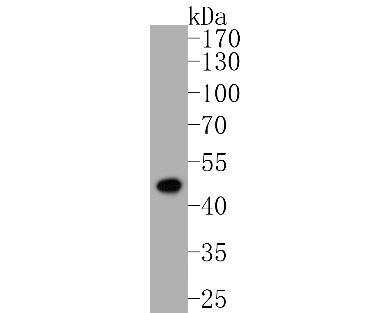Western blot analysis of FH on K562 cell lysates. Proteins were transferred to a PVDF membrane and blocked with 5% BSA in PBS for 1 hour at room temperature. The primary antibody (ER1902-01, 1/500) was used in 5% BSA at room temperature for 2 hours. Goat Anti-Rabbit IgG - HRP Secondary Antibody (HA1001) at 1:5,000 dilution was used for 1 hour at room temperature.