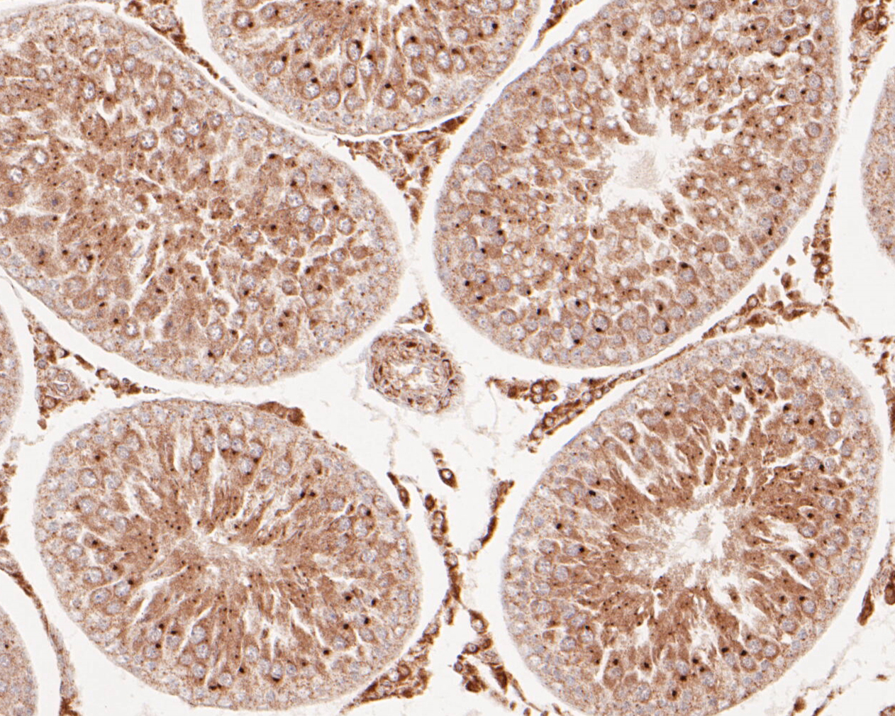 Immunohistochemical analysis of paraffin-embedded rat testis tissue using anti-FH antibody. The section was pre-treated using heat mediated antigen retrieval with Tris-EDTA buffer (pH 8.0-8.4) for 20 minutes.The tissues were blocked in 5% BSA for 30 minutes at room temperature, washed with ddH2O and PBS, and then probed with the primary antibody (ER1902-01, 1/50) for 30 minutes at room temperature. The detection was performed using an HRP conjugated compact polymer system. DAB was used as the chromogen. Tissues were counterstained with hematoxylin and mounted with DPX.