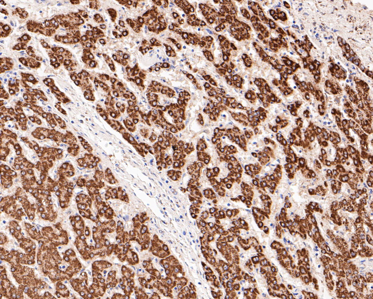 Immunohistochemical analysis of paraffin-embedded human liver tissue using anti-FH antibody. The section was pre-treated using heat mediated antigen retrieval with Tris-EDTA buffer (pH 8.0-8.4) for 20 minutes.The tissues were blocked in 5% BSA for 30 minutes at room temperature, washed with ddH2O and PBS, and then probed with the primary antibody (ER1902-01, 1/200) for 30 minutes at room temperature. The detection was performed using an HRP conjugated compact polymer system. DAB was used as the chromogen. Tissues were counterstained with hematoxylin and mounted with DPX.
