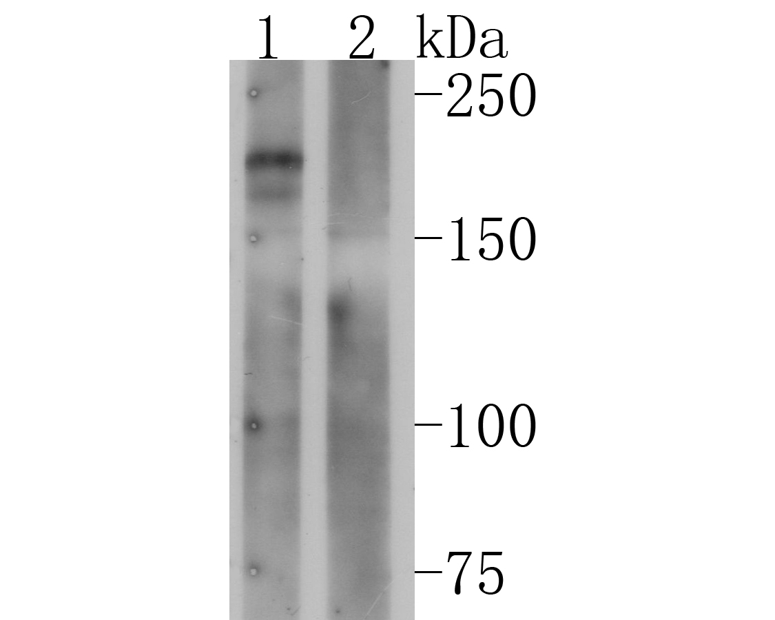 Western blot analysis of CD45 on U937 cell lysates using anti-CD45 antibody.<br />
Lane 1: Anti-CD45 Antibody (1/500). <br />
Lane 2: Anti-CD45 Antibody, pre-incubated with the immunizaiton peptide.