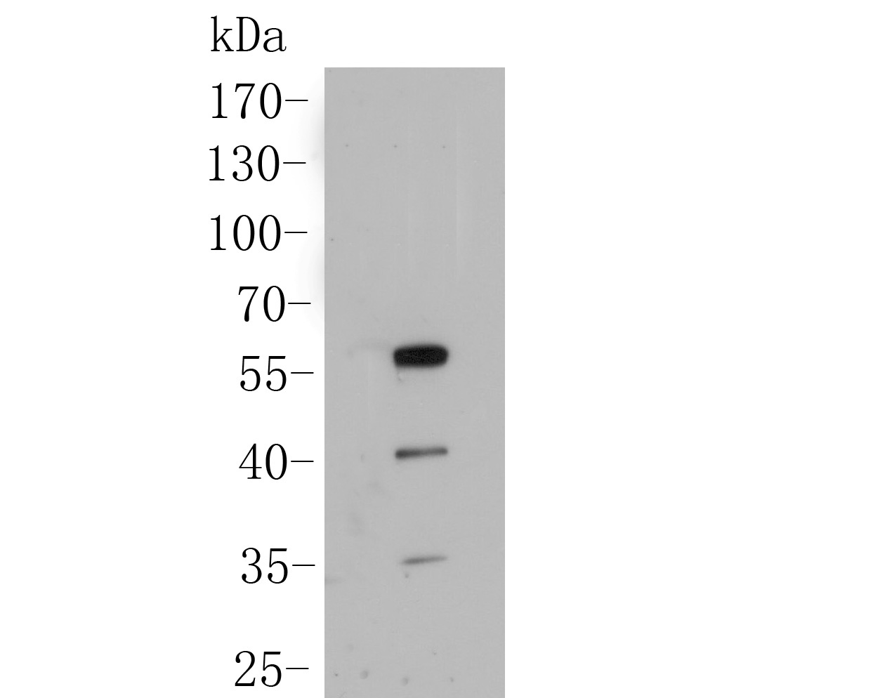 Western blot analysis of SHE on Zebrafish tissue lysate. Proteins were transferred to a PVDF membrane and blocked with 5% BSA in PBS for 1 hour at room temperature. The primary antibody (ER1902-03, 1/500) was used in 5% BSA at room temperature for 2 hours. Goat Anti-Rabbit IgG - HRP Secondary Antibody (HA1001) at 1:5,000 dilution was used for 1 hour at room temperature.