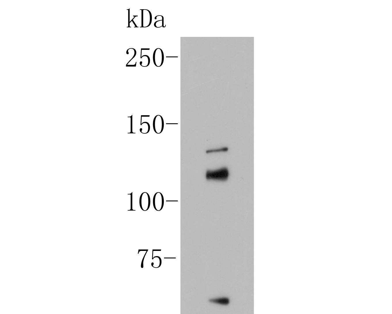 Western blot analysis of  on A549 cell lysate. Proteins were transferred to a PVDF membrane and blocked with 5% BSA in PBS for 1 hour at room temperature. The primary antibody (ER1902-04, 1/500) was used in 5% BSA at room temperature for 2 hours. Goat Anti-Rabbit IgG - HRP Secondary Antibody (HA1001) at 1:5,000 dilution was used for 1 hour at room temperature.
