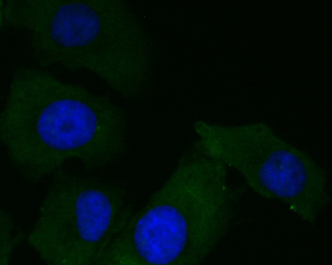 ICC staining of KCNMA1 in A549 cells (green). Formalin fixed cells were permeabilized with 0.1% Triton X-100 in TBS for 10 minutes at room temperature and blocked with 1% Blocker BSA for 15 minutes at room temperature. Cells were probed with the primary antibody (ER1902-04, 1/100) for 1 hour at room temperature, washed with PBS. Alexa Fluor®488 Goat anti-Rabbit IgG was used as the secondary antibody at 1/100 dilution. The nuclear counter stain is DAPI (blue)