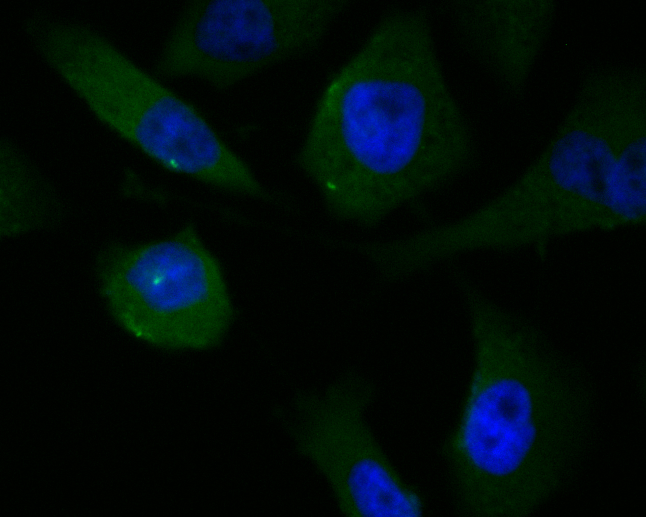 ICC staining of KCNMA1 in PC-3M cells (green). Formalin fixed cells were permeabilized with 0.1% Triton X-100 in TBS for 10 minutes at room temperature and blocked with 1% Blocker BSA for 15 minutes at room temperature. Cells were probed with the primary antibody (ER1902-04, 1/100) for 1 hour at room temperature, washed with PBS. Alexa Fluor®488 Goat anti-Rabbit IgG was used as the secondary antibody at 1/100 dilution. The nuclear counter stain is DAPI (blue)