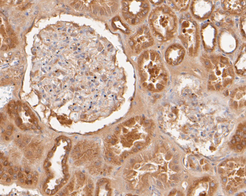 Immunohistochemical analysis of paraffin-embedded human kidney tissue using anti-KCNMA1 antibody. The section was pre-treated using heat mediated antigen retrieval with Tris-EDTA buffer (pH 8.0-8.4) for 20 minutes.The tissues were blocked in 5% BSA for 30 minutes at room temperature, washed with ddH2O and PBS, and then probed with the primary antibody (ER1902-05, 1/50) for 30 minutes at room temperature. The detection was performed using an HRP conjugated compact polymer system. DAB was used as the chromogen. Tissues were counterstained with hematoxylin and mounted with DPX.