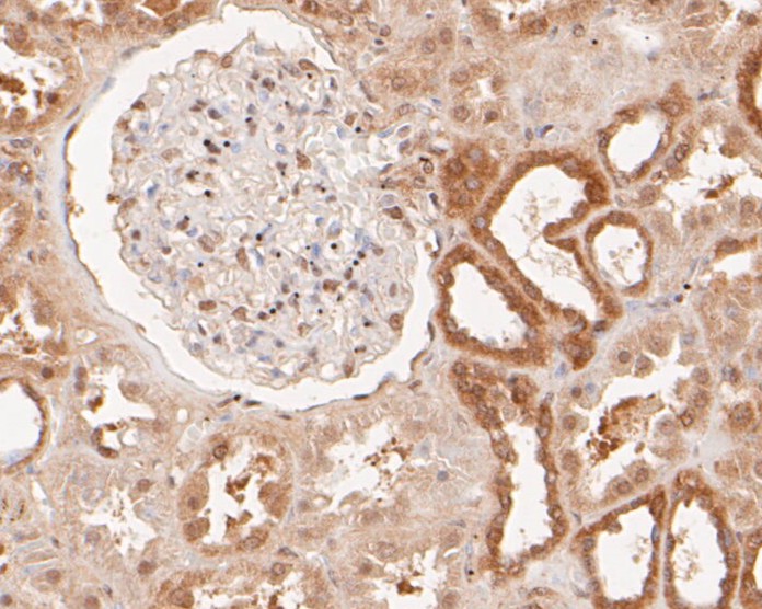 Immunohistochemical analysis of paraffin-embedded human kidney tissue using anti-KCNK2 antibody. The section was pre-treated using heat mediated antigen retrieval with Tris-EDTA buffer (pH 8.0-8.4) for 20 minutes.The tissues were blocked in 5% BSA for 30 minutes at room temperature, washed with ddH2O and PBS, and then probed with the primary antibody (ER1902-06, 1/100) for 30 minutes at room temperature. The detection was performed using an HRP conjugated compact polymer system. DAB was used as the chromogen. Tissues were counterstained with hematoxylin and mounted with DPX.