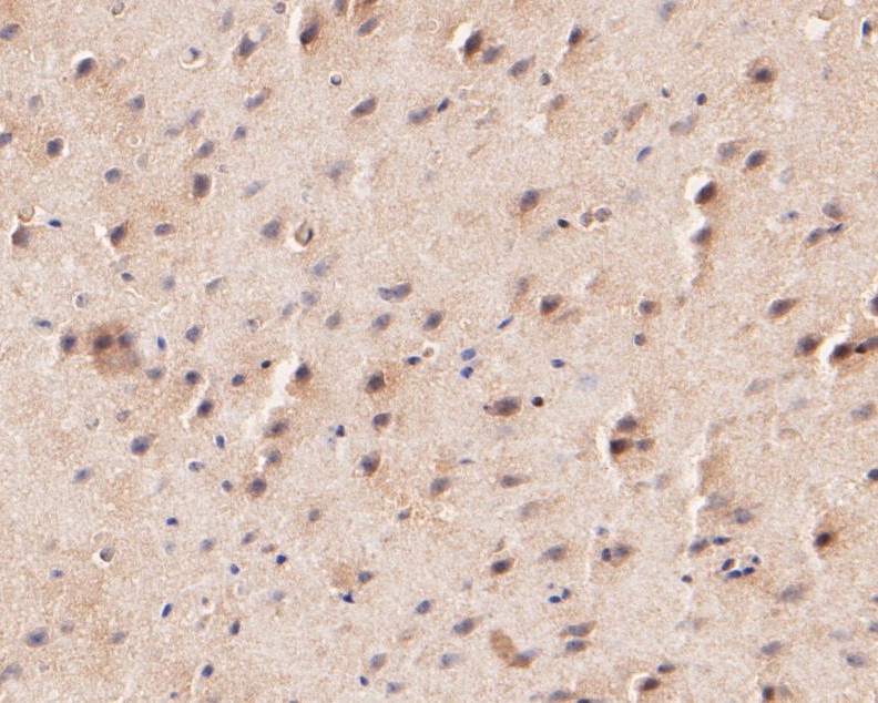 Immunohistochemical analysis of paraffin-embedded mouse brain tissue using anti-KCNK2 antibody. The section was pre-treated using heat mediated antigen retrieval with Tris-EDTA buffer (pH 8.0-8.4) for 20 minutes.The tissues were blocked in 5% BSA for 30 minutes at room temperature, washed with ddH2O and PBS, and then probed with the primary antibody (ER1902-06, 1/100) for 30 minutes at room temperature. The detection was performed using an HRP conjugated compact polymer system. DAB was used as the chromogen. Tissues were counterstained with hematoxylin and mounted with DPX.