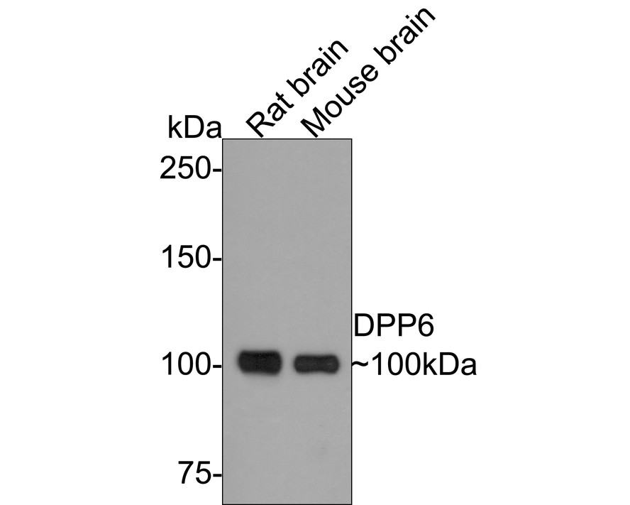 Western blot analysis of DPP6 on rat brain tissue lysate. Proteins were transferred to a PVDF membrane and blocked with 5% BSA in PBS for 1 hour at room temperature. The primary antibody (ER1902-07, 1/500) was used in 5% BSA at room temperature for 2 hours. Goat Anti-Rabbit IgG - HRP Secondary Antibody (HA1001) at 1:5,000 dilution was used for 1 hour at room temperature.