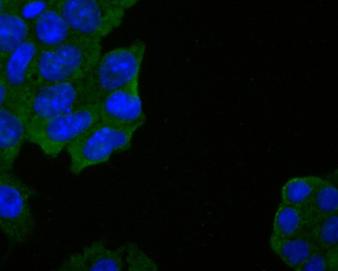 ICC staining of DPP6 in F9 cells (green). Formalin fixed cells were permeabilized with 0.1% Triton X-100 in TBS for 10 minutes at room temperature and blocked with 1% Blocker BSA for 15 minutes at room temperature. Cells were probed with the primary antibody (ER1902-07, 1/100) for 1 hour at room temperature, washed with PBS. Alexa Fluor®488 Goat anti-Rabbit IgG was used as the secondary antibody at 1/100 dilution. The nuclear counter stain is DAPI (blue).