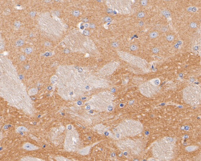 ICC staining of DPP6 in N2A cells (green). Formalin fixed cells were permeabilized with 0.1% Triton X-100 in TBS for 10 minutes at room temperature and blocked with 1% Blocker BSA for 15 minutes at room temperature. Cells were probed with the primary antibody (ER1902-07, 1/100) for 1 hour at room temperature, washed with PBS. Alexa Fluor®488 Goat anti-Rabbit IgG was used as the secondary antibody at 1/100 dilution. The nuclear counter stain is DAPI (blue).
