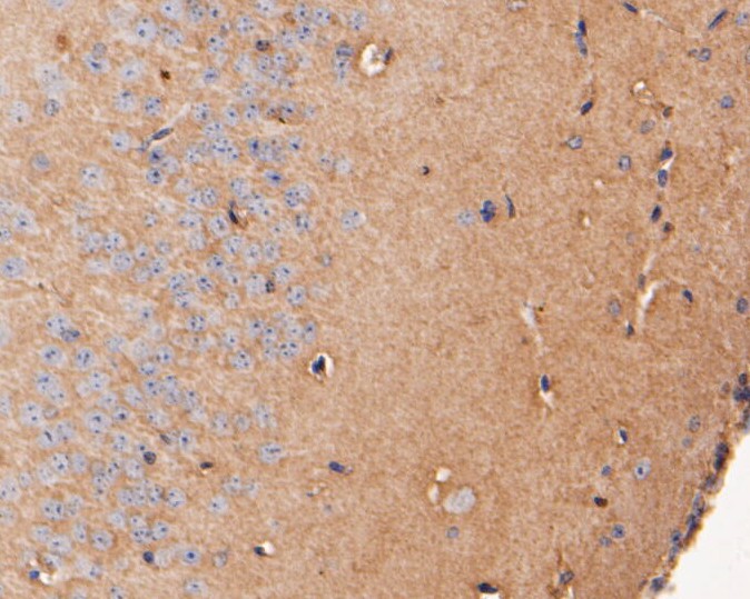 Immunohistochemical analysis of paraffin-embedded rat brain tissue using anti-DPP6 antibody. The section was pre-treated using heat mediated antigen retrieval with Tris-EDTA buffer (pH 8.0-8.4) for 20 minutes.The tissues were blocked in 5% BSA for 30 minutes at room temperature, washed with ddH2O and PBS, and then probed with the primary antibody (ER1902-07, 1/100) for 30 minutes at room temperature. The detection was performed using an HRP conjugated compact polymer system. DAB was used as the chromogen. Tissues were counterstained with hematoxylin and mounted with DPX.