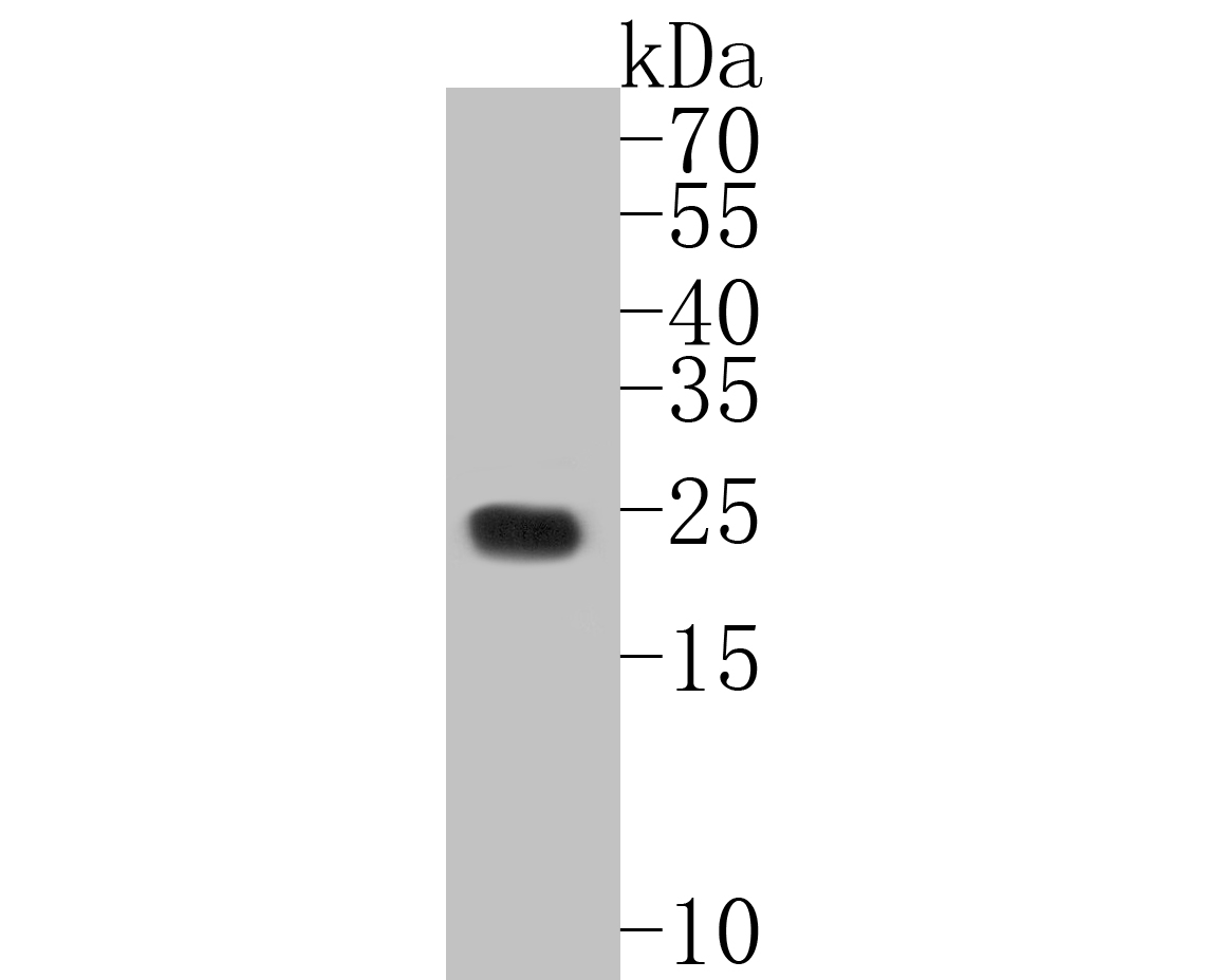 Western blot analysis of EMC10 on SH-SY5Y cell lysates. Proteins were transferred to a PVDF membrane and blocked with 5% BSA in PBS for 1 hour at room temperature. The primary antibody (ER1902-08, 1/500) was used in 5% BSA at room temperature for 2 hours. Goat Anti-Rabbit IgG - HRP Secondary Antibody (HA1001) at 1:5,000 dilution was used for 1 hour at room temperature.