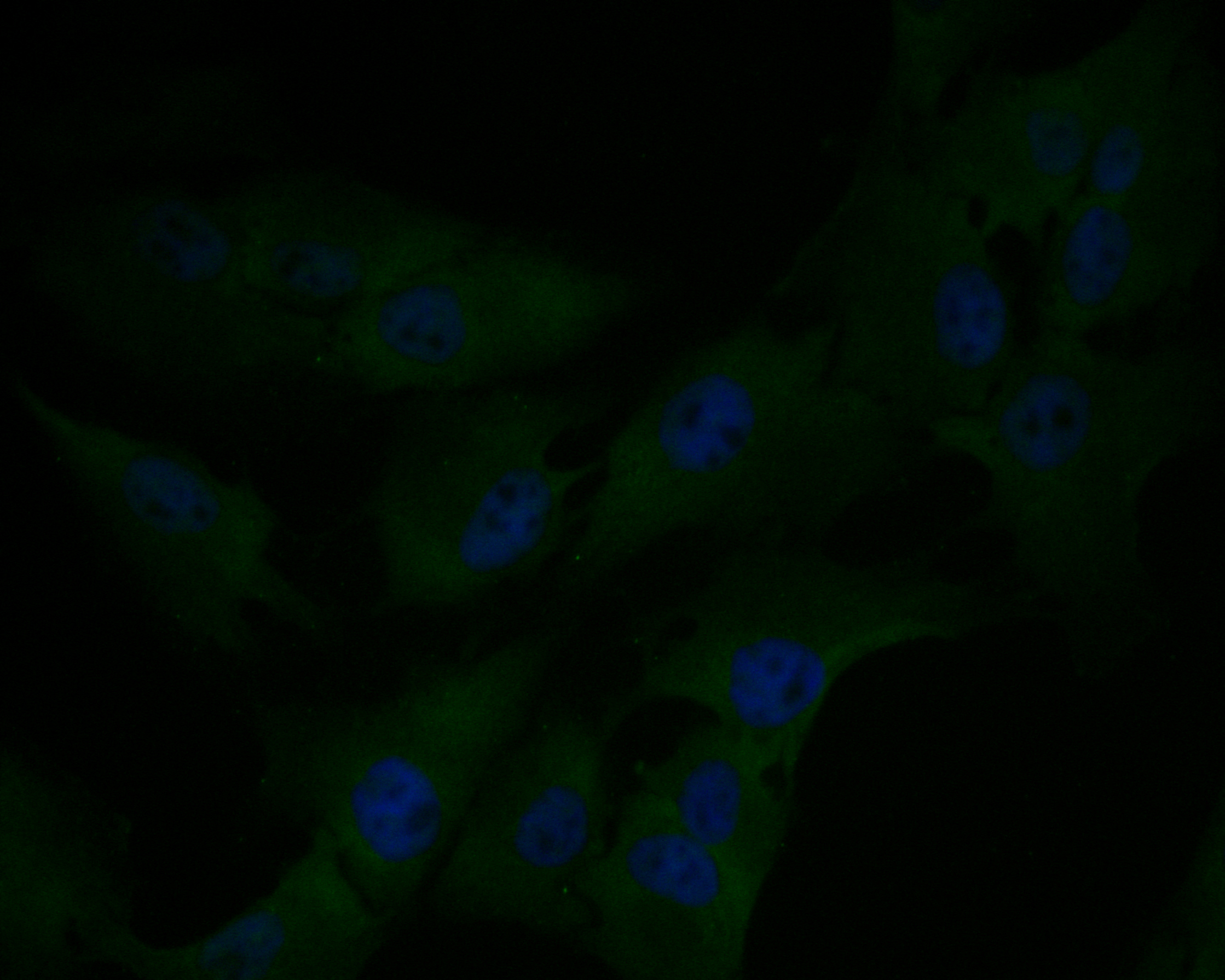 ICC staining of EMC10 in MG-63 cells (green). Formalin fixed cells were permeabilized with 0.1% Triton X-100 in TBS for 10 minutes at room temperature and blocked with 1% Blocker BSA for 15 minutes at room temperature. Cells were probed with the primary antibody (ER1902-08, 1/200) for 1 hour at room temperature, washed with PBS. Alexa Fluor®488 Goat anti-Rabbit IgG was used as the secondary antibody at 1/1,000 dilution. The nuclear counter stain is DAPI (blue).