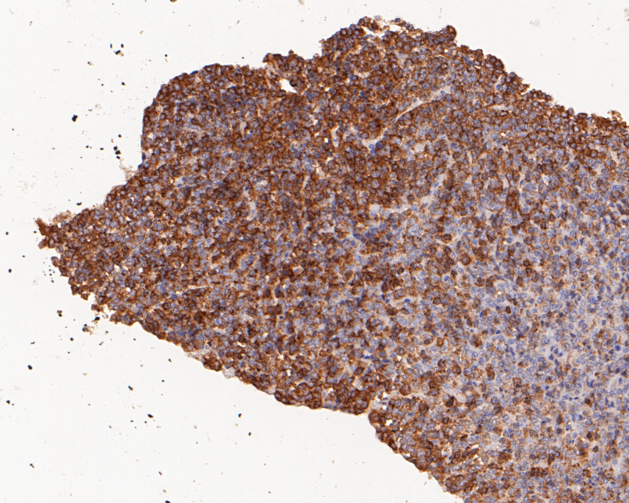 Immunohistochemical analysis of paraffin-embedded mouse pituitary tissue using anti-EMC10 antibody. The section was pre-treated using heat mediated antigen retrieval with Tris-EDTA buffer (pH 8.0-8.4) for 20 minutes.The tissues were blocked in 5% BSA for 30 minutes at room temperature, washed with ddH2O and PBS, and then probed with the primary antibody (ER1902-08, 1/200) for 30 minutes at room temperature. The detection was performed using an HRP conjugated compact polymer system. DAB was used as the chromogen. Tissues were counterstained with hematoxylin and mounted with DPX.